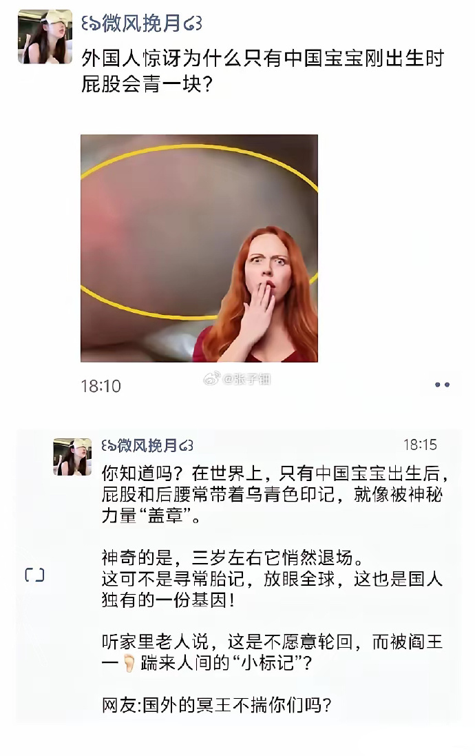 中国宝宝专属屁股青的"出厂印记"？全球唯一之谜！